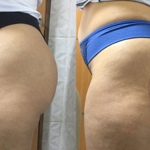 Estética Facial  por Beleza e Estética Jeane Lima - Esteticista