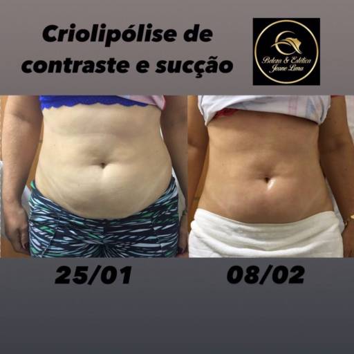 Estética Facial  por Beleza e Estética Jeane Lima - Esteticista