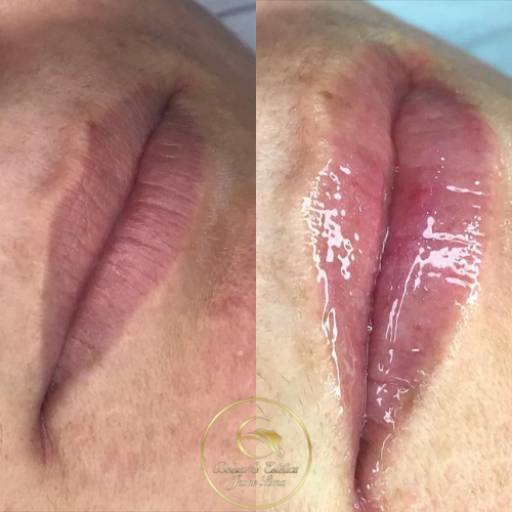Nutrigloss por Beleza e Estética Jeane Lima - Esteticista Nutrigloss por Beleza e Estética Jeane Lima - Esteticista