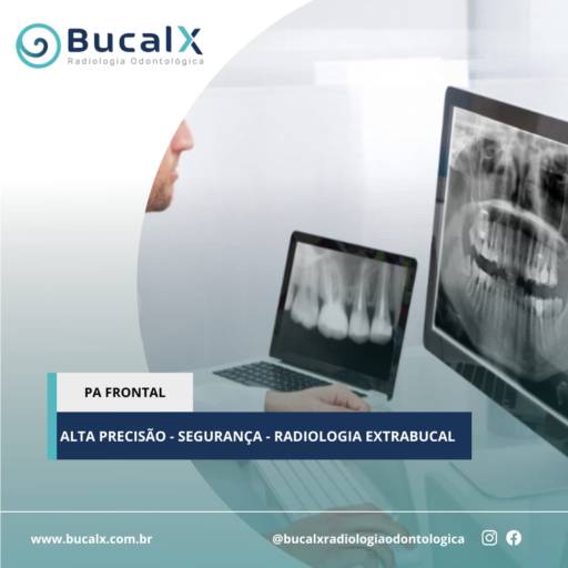 PA Frontal - Radiologia Odontológica  por Bucalx Radiologia Odontológica