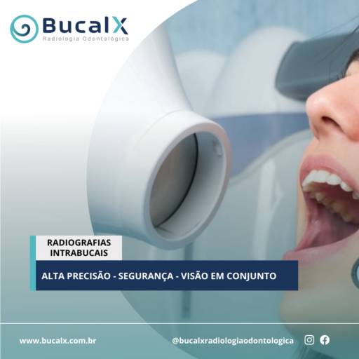Radiografia Intrabucal  por Bucalx Radiologia Odontológica