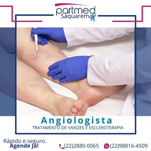 Comprar o produto de Angiologista  em Angiologia pela empresa Partmed Saúde e Medicina em Saquarema, RJ por Solutudo