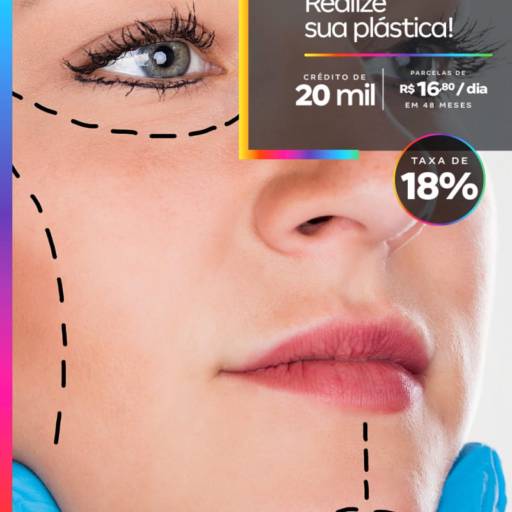 Consórcio para Plástica