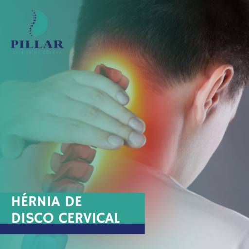 Comprar o produto de HÉRNIA DE DISCO CERVICAL em Fisioterapia pela empresa Pillar - Clinica da Coluna em Botucatu, SP por Solutudo
