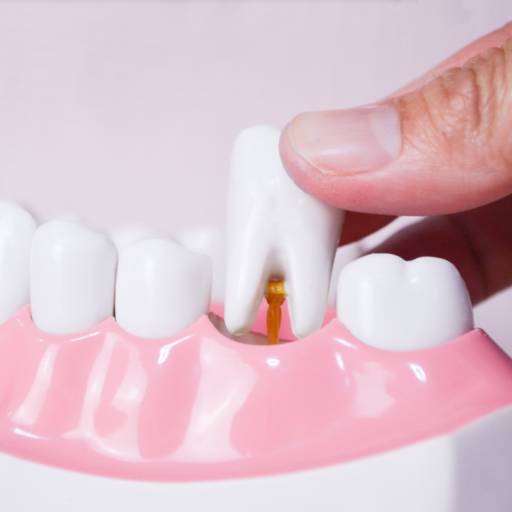 Dentista para extração de dente em Bauru 