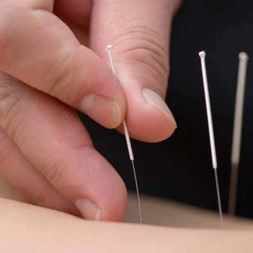 Dry needling e acupuntura por João Vitor Bezerra Terapias em Itu