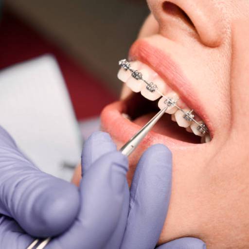 Aparelho Dentário  por Centro Odontológico Meu Sorriso