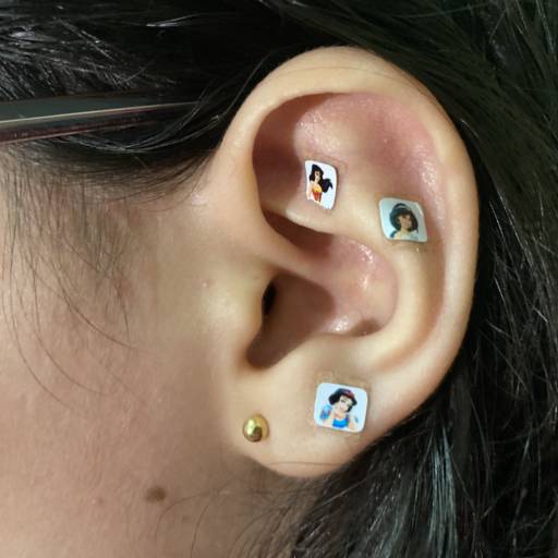 Acupuntura Auricular em Jaú, SP por Lucas Mageste Acupuntura