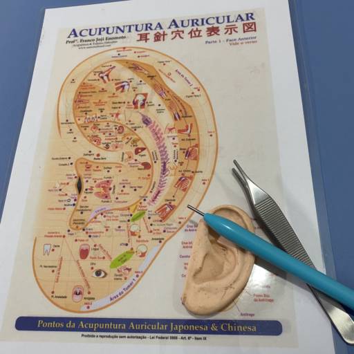 Acupuntura Auricular em Jaú, SP por Lucas Mageste Acupuntura