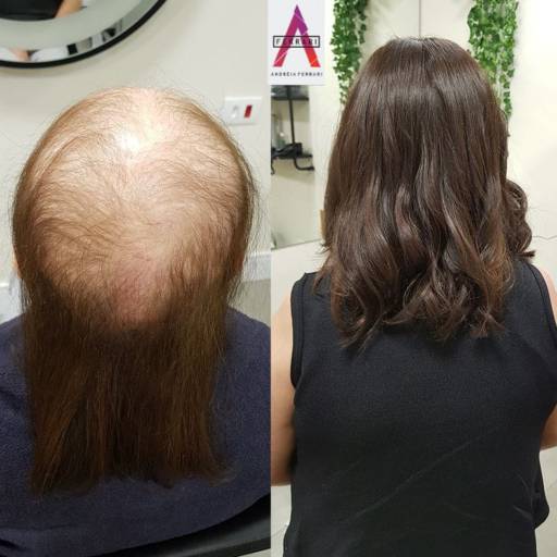 PRÓTESE CAPILAR FEMININA  por Salão de Beleza Andréia Ferrari