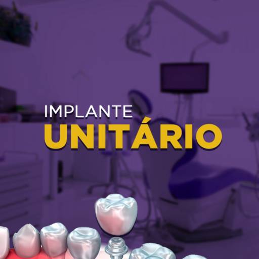 Comprar o produto de Implantes Dentários em Odontologia pela empresa Sorrix Odontologia  em Avaré, SP por Solutudo