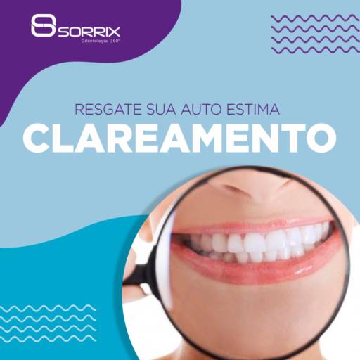 Clareamento Dental por Sorrix Odontologia 
