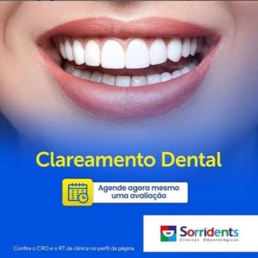 Clareamento Dental por Sorridents Clínica Odontológica