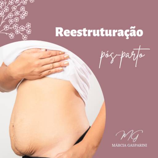 RPP - Reestruturação pós parto em Bauru por Fisioterapeuta Márcia Gasparini