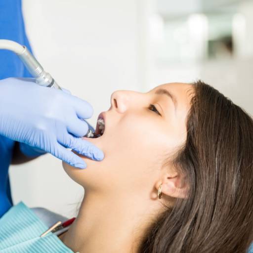 Limpeza dentária (profilaxia) em Bauru