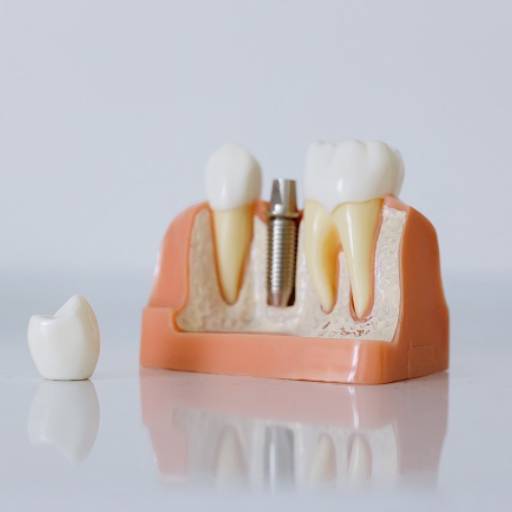 Comprar o produto de Dente Provisório Unitário em Odontologia pela empresa Tehari Odontologia Inteligente em Osasco, SP por Solutudo