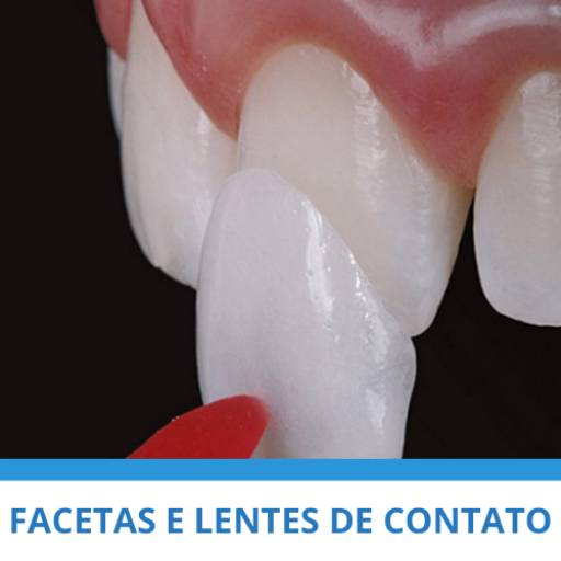 Comprar o produto de Facetas e Lentes de Contato em Odontologia pela empresa Clínica Mário Munhoz em Itapetininga, SP por Solutudo
