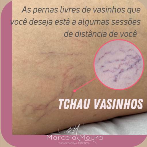 Secagem de microvasos