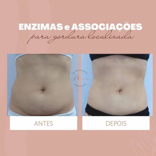 Redução de gordura localizada