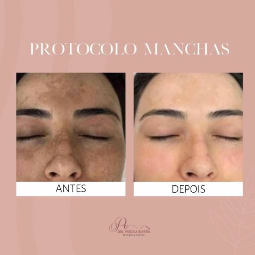 Tratamento de manchas
