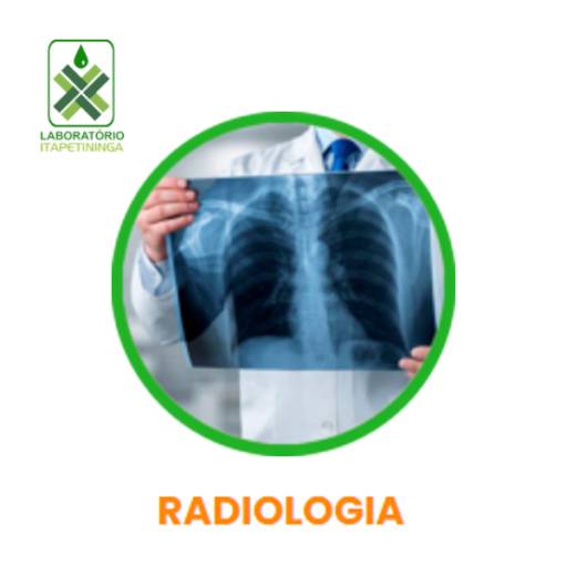 Comprar o produto de Radiologia em Radiologia e Diagnóstico por Imagem pela empresa Laboratório Itapetininga - Análises Clínicas e Imagem em Itapetininga, SP por Solutudo