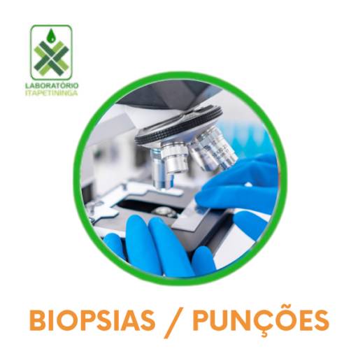 Laboratório que faça Biopsias/ Punções em Itapetininga