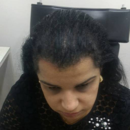 Tratamento Capilar por Silvana Almeida estética