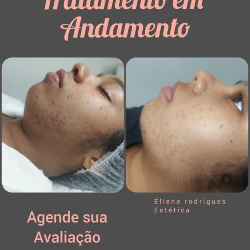 Eliene Rodrigues Estética por Solutudo