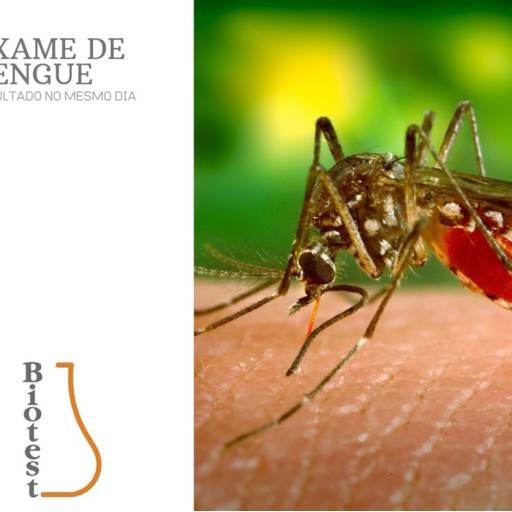 Exame de Dengue por Biotest