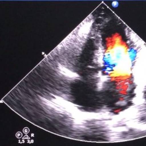 Ecodopplercardiografia por Cardioss Clínica Cardiológica