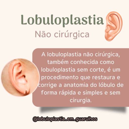 Lobuloplastia não cirúrgica em Guarulhos 