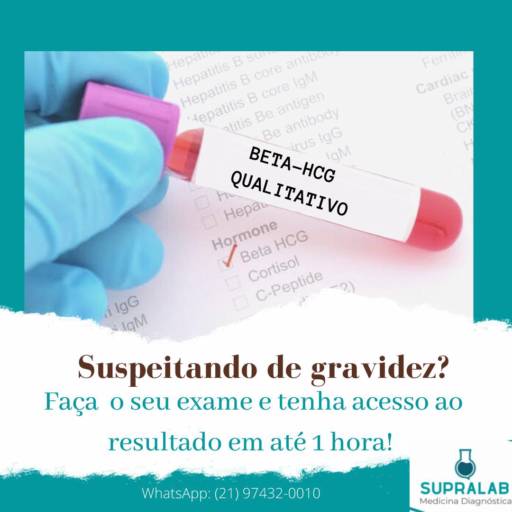 Teste de gravidez por SUPRALAB Medicina Diagnóstica