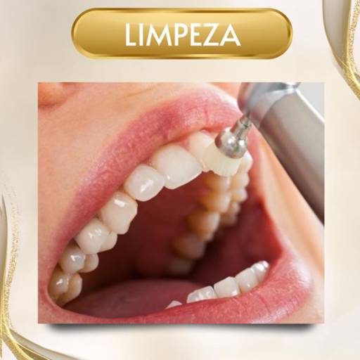 Comprar o produto de Limpeza de Dentes em Odontologia pela empresa Lafayette Dent em Fortaleza, CE por Solutudo