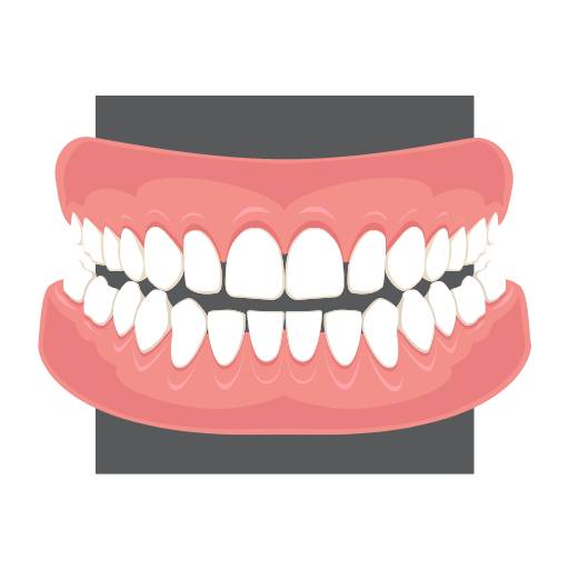 Lente de contato dentária por Nunes Odontologia