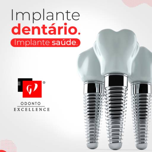 Implante Dentário por Odonto Excellence - Elaine R. da Silva CRO:110.721 CRO/SP:14.557