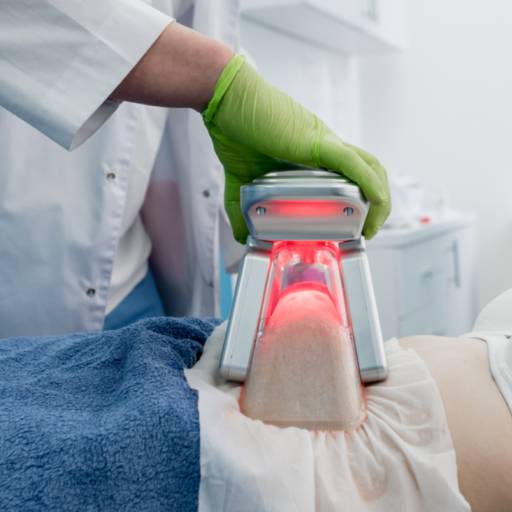 Criolipolise em Itupeva