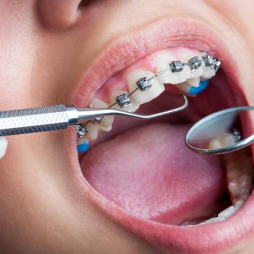 Remoção do Dente Siso por Floreli Centro Integrado em Odontologia