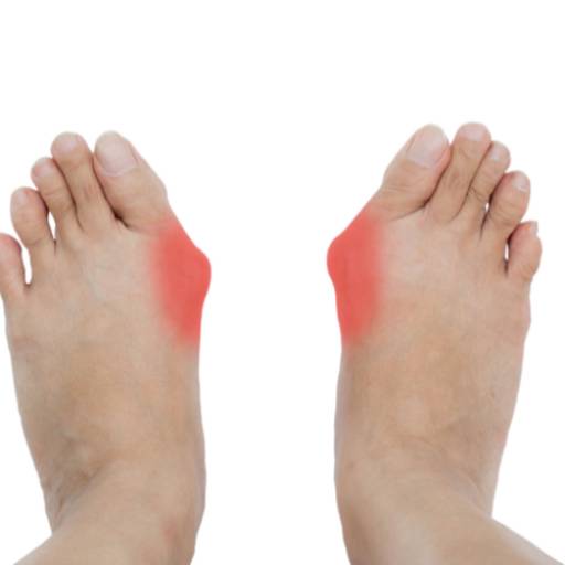 Dores nos Pés e Joanetes