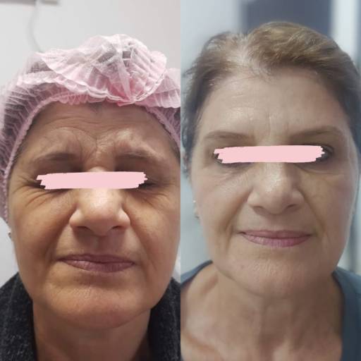Plano de gerenciamento de cuidados com a pele - Rejuvenescimento por Vivare Plano de gerenciamento de cuidados com a pele - Rejuvenescimento por Vivare