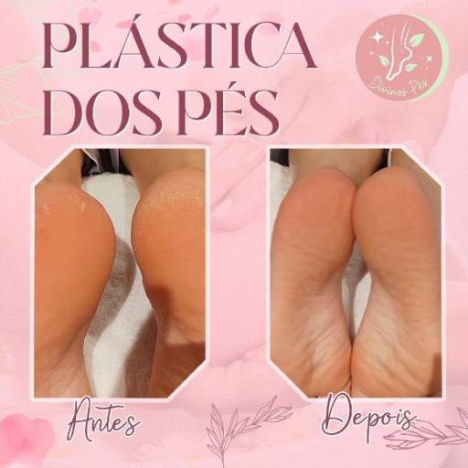 A vida fica melhor depois de uma sessão de cuidados com os pés. 