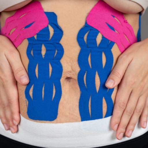 Diástase em Juiz de Fora por Espaço Mônica Groppo 