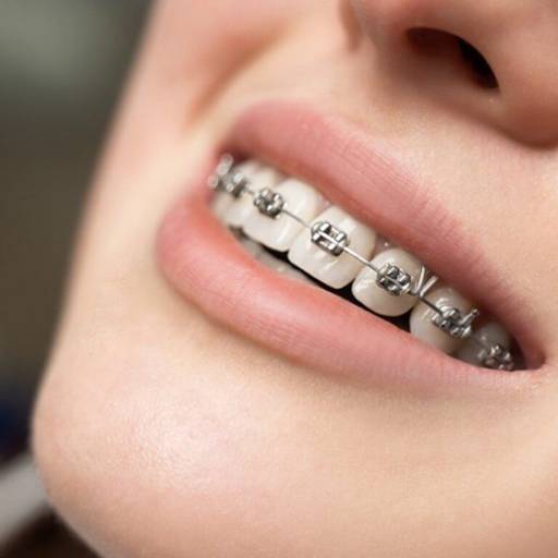 Comprar o produto de Correção dentária em Odontologia pela empresa Verità Odontologia  em Vinhedo, SP por Solutudo