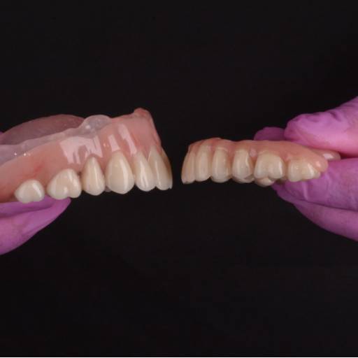 Prótese Total e Fixa - Sorriso Restaurado com Conforto em Colatina