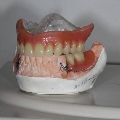 Prótese Total e Parcial - Reabilitação Oral Completa em Colatina