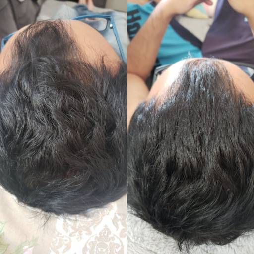 Tratamento capilar Healthy hair em Bauru por Regina Castro Beauty