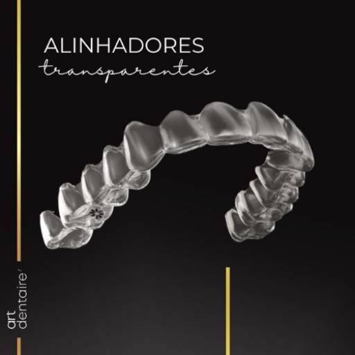 Alinhadores Transparentes por Art Dentaire - Harmonizando Sorrisos