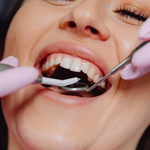 Estética Dental: Sorriso Perfeito e Natural em Uberlândia/MG
