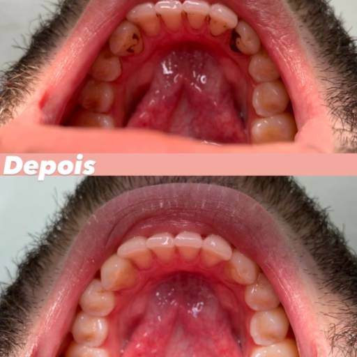 Comprar o produto de Profilaxia- Limpeza dentária  em Odontologia pela empresa Dra. Leticia Borges em Mineiros, GO por Solutudo
