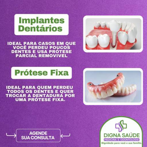 Implante Dentário – Restaure seu Sorriso com Tecnologia e Precisão – Excelência da Digna Saúde por Clínica Digna Saúde
