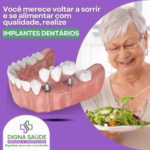  Prótese sobre Implante em Resina – Estabilidade e Estética em Harmonia – Digna Saúde – Ribeirão Preto/SP